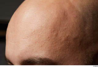  HD Face Skin Neeo eyebrow face forehead skin pores skin texture wrinkles 0001.jpg